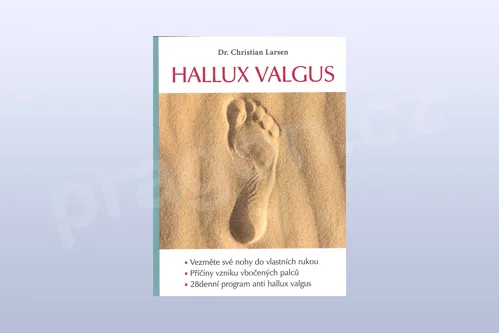 Hallux valgus, Christian Larsen