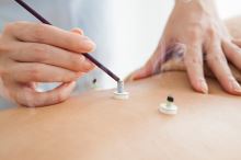 Moxa a moxování pro vaši kondici