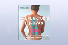 Akupunkturní tejpování Akupunkturní tejpování