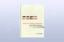Atlas of Tongue Diagnosis for AIDS Patients