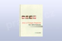 Atlas of Tongue Diagnosis for AIDS Patients